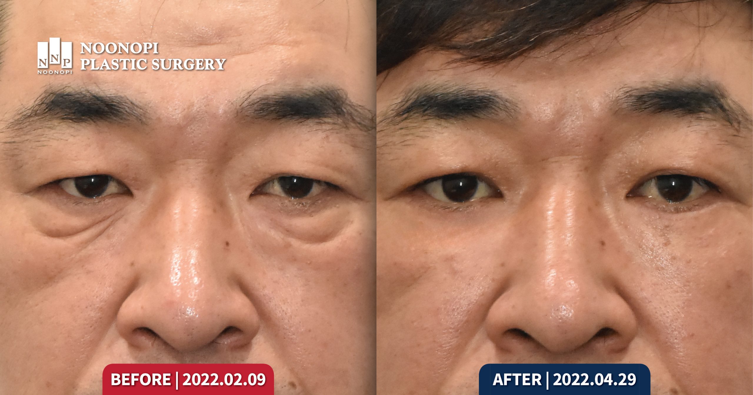 Works 얼굴 노화의 특징 003 scaled