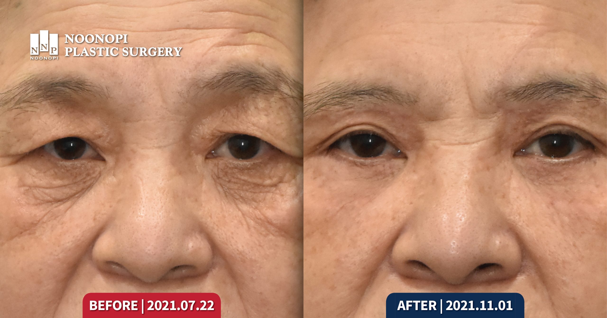 Works 얼굴 노화의 특징 005 scaled