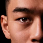 남자 눈 성형 : 무쌍 vs 속쌍