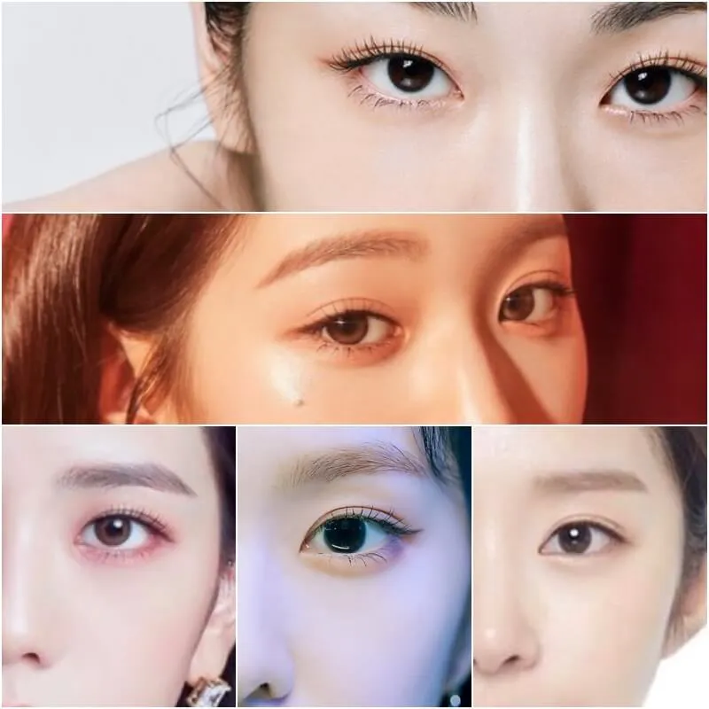 쌍꺼풀-종류