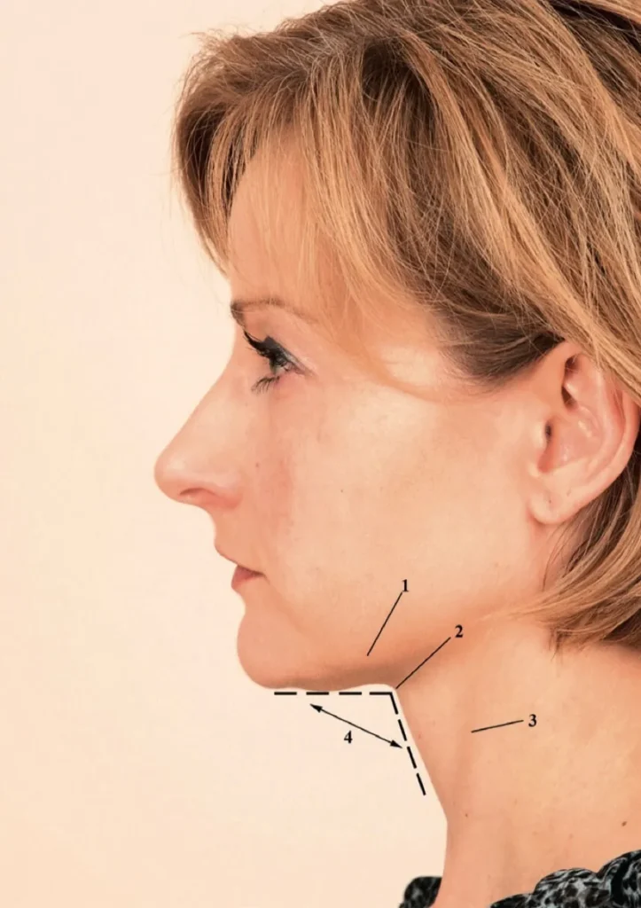 아름다운 목의 조건