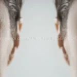 눈밑지방재배치와 눈밑주름 수술의 역사에서 얻은 교훈