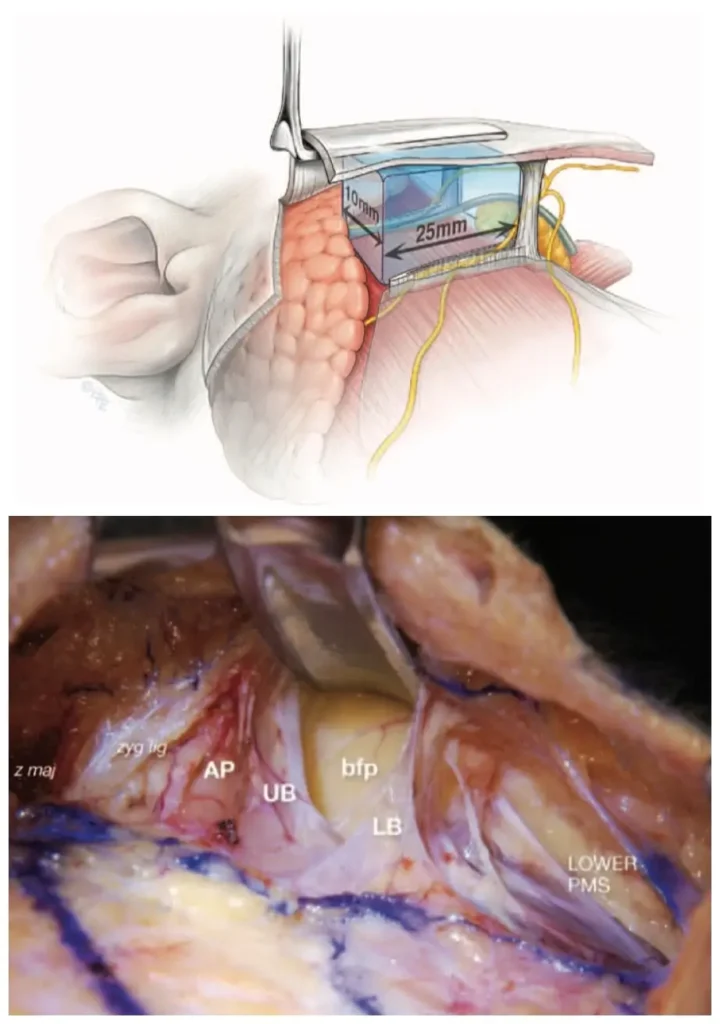 Mendelson premasseter space