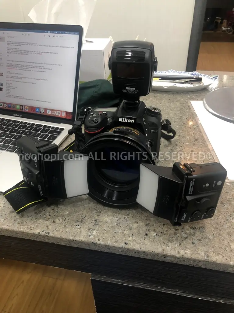 성형외과-임상사진