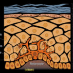 멜라닌 세포 모식도