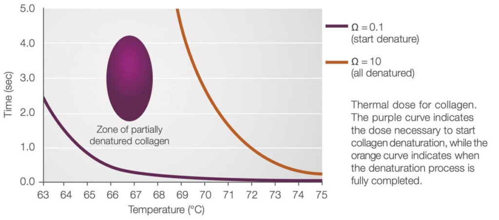 프로파운드