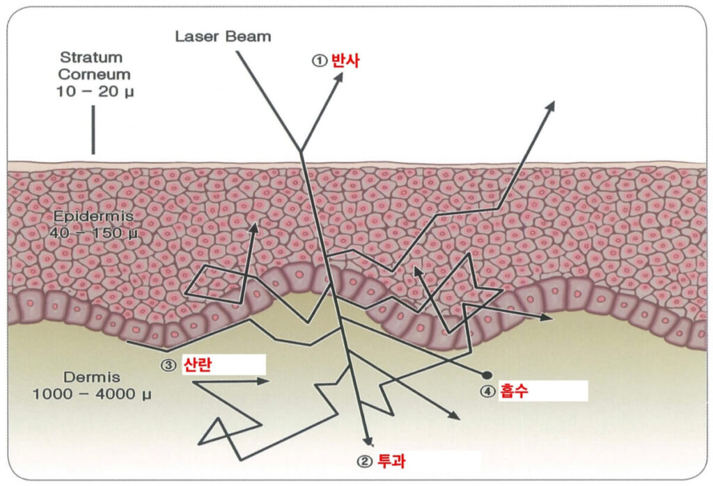 레이저 산란 투과