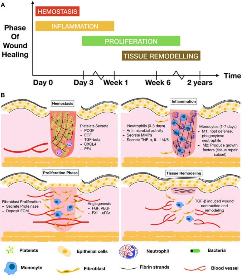 상처-치유-단계
