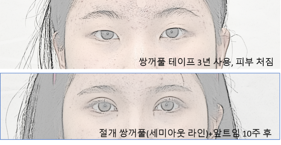 그림1