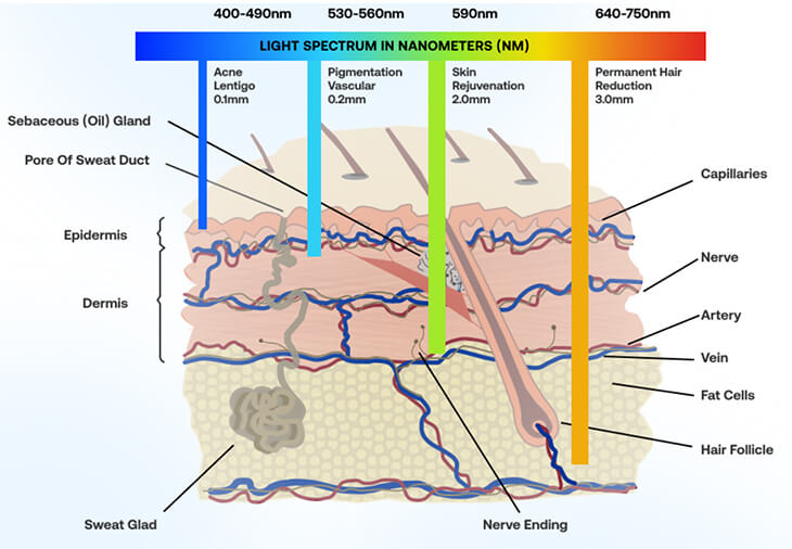 laser-skin-penetration