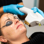 Unlocking Youthful Radiance: The Wonders of Skin Tightening Procedures for Korean Dermatology