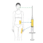 Facial fat grafting : Noonopi Plastic Surgery Korea