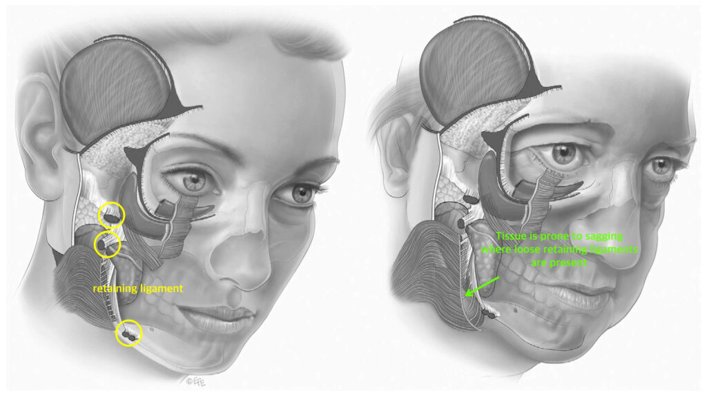 Facial-retaining-ligaments