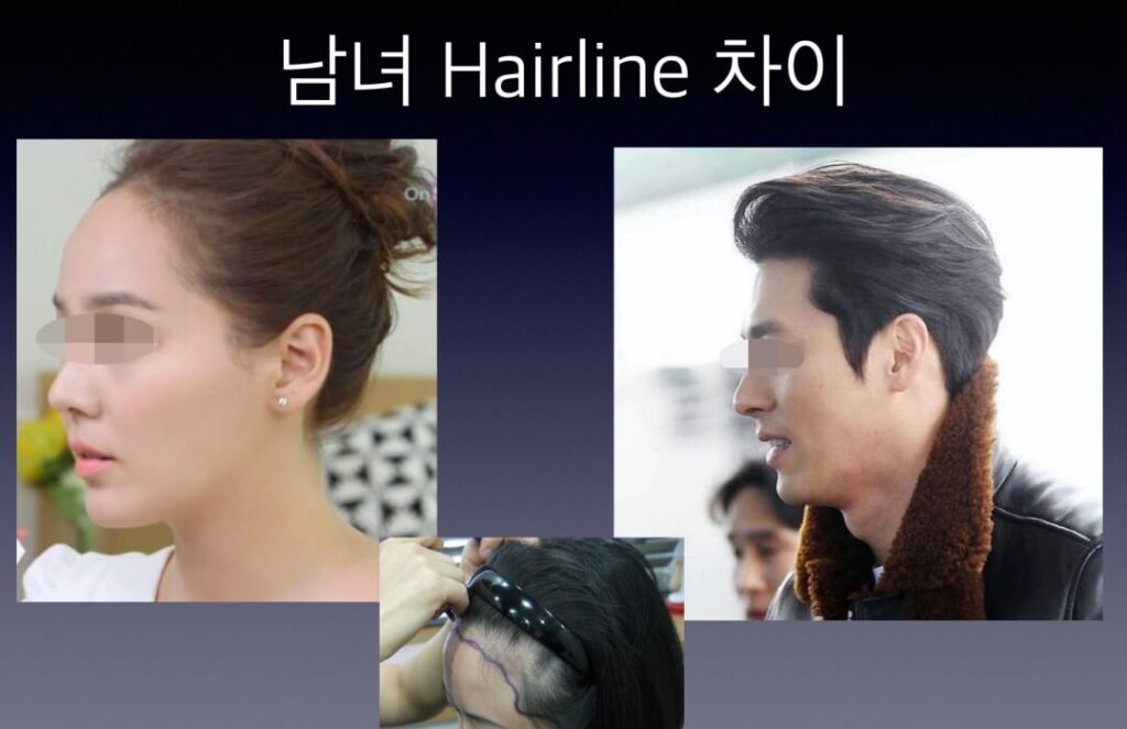 남녀-헤어라인