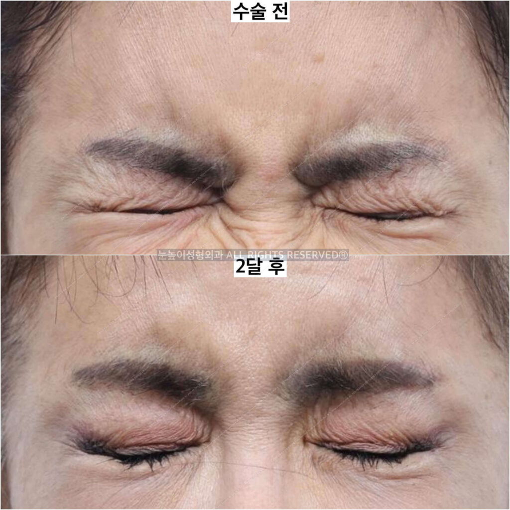 이마거상연예인