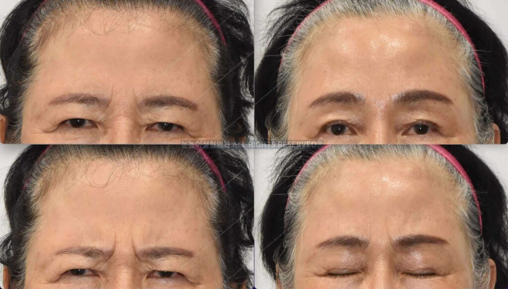 연예인이마거상