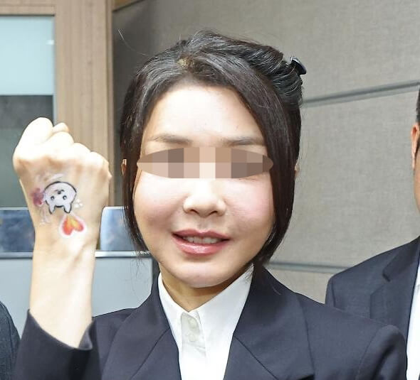 이마축소술-부작용-흉터