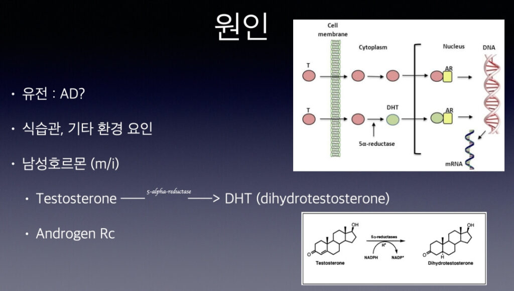 남성-탈모-원인