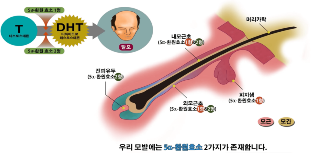 탈모약-효소억제제