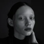 안검하수 수술이 필요한 이유 | 중년 눈 성형과 치료 방법